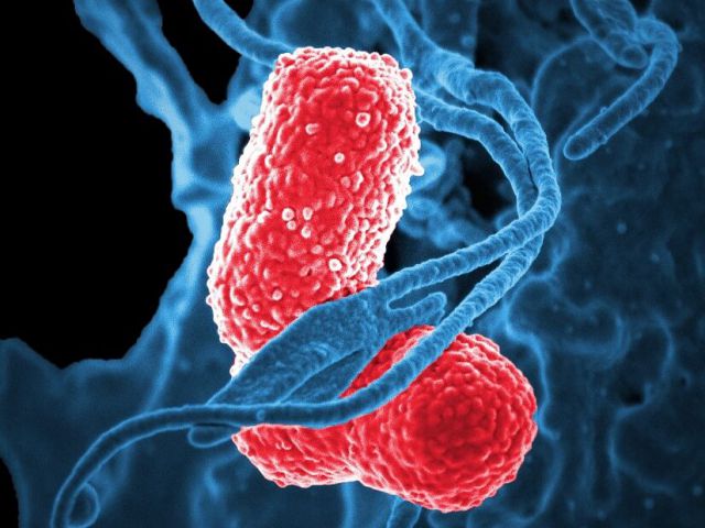 bacteria screened in high resolution via electron microscope