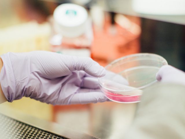 Bioscience Bioscience includes serveral approaches of assay development and in vivo pharmacology within the drug discovery process