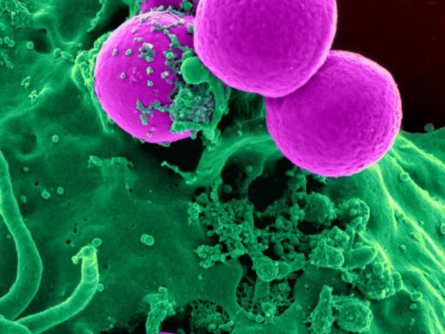 Oncology Human oncological cells evaluated on disease indications within the drug discovery process